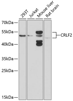 Western blot - CRLF2 Polyclonal Antibody 