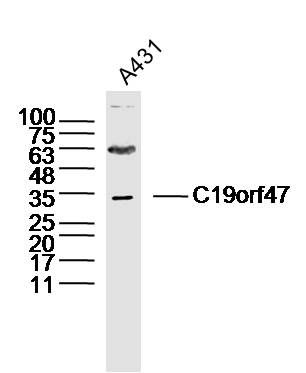 Fig1: Sample: A431 Cell(Human)Lysate at 40 ug; Primary: Anti-C19orf47 at 1/300 dilution; Secondary: IRDye800CW Goat Anti-Rabbit IgG at 1/20000 dilution; Predicted band size: 45kD; Observed band size: 33kD