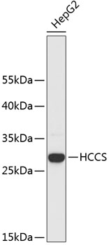 Western blot - HCCS Polyclonal Antibody 