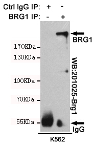 Immunoprecipitation analysis of Hela cells lysates. IP: BRG1 mouse mAb(168211); WB: BRG1 mouse mAb(201025).