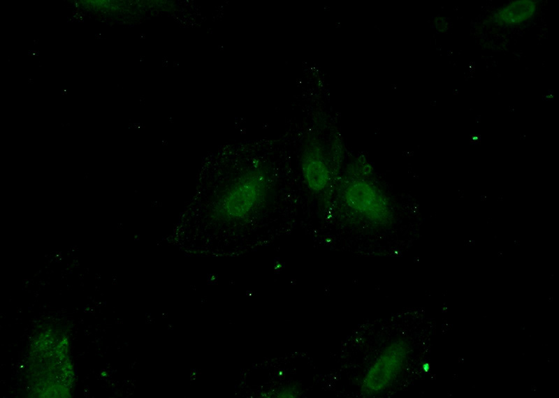 Immunofluorescent analysis of A549 cells using Catalog No:117003(ZNF549 Antibody) at dilution of 1:50 and Alexa Fluor 488-congugated AffiniPure Goat Anti-Rabbit IgG(H+L)