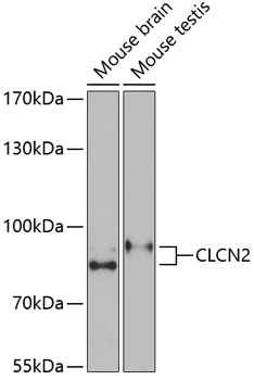 Western blot - CLCN2 Polyclonal Antibody 