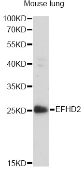 Western blot - EFHD2 Polyclonal Antibody 