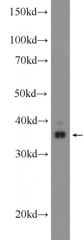 SH-SY5Y cells were subjected to SDS PAGE followed by western blot with Catalog No:117137(BHLHE22 Antibody) at dilution of 1:300