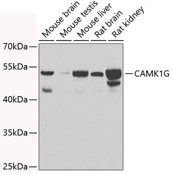 Western blot - CAMK1G Polyclonal Antibody 