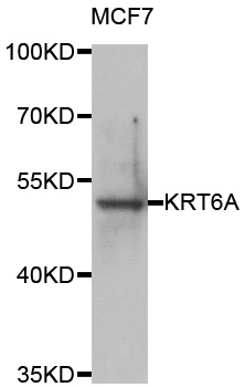 Western blot - KRT6A Polyclonal Antibody 