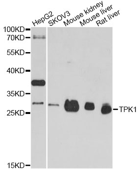Western blot - TPK1 Polyclonal Antibody 