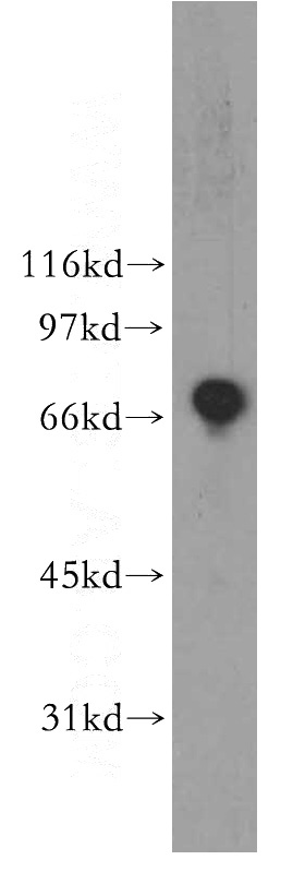 Jurkat cells were subjected to SDS PAGE followed by western blot with Catalog No:116906(ZBP1 antibody) at dilution of 1:400