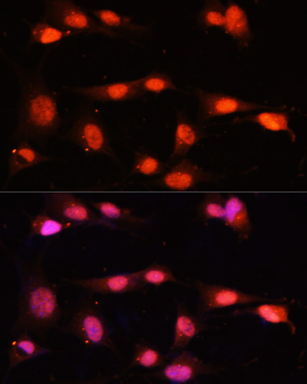 Immunofluorescence - ZNF264 Polyclonal Antibody 