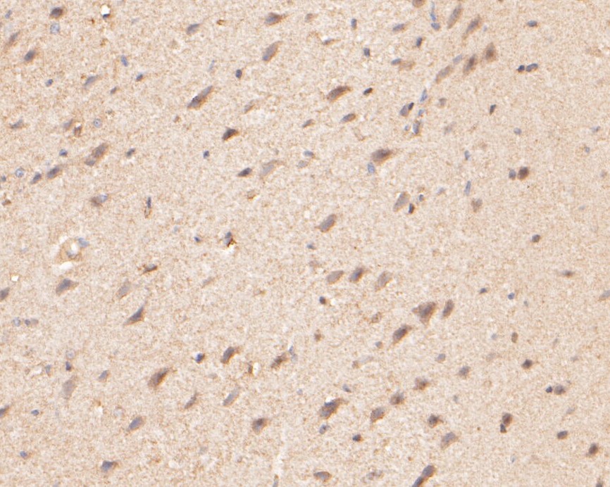 Fig4: Immunohistochemical analysis of paraffin-embedded rat brain tissue using anti-ZAC antibody. The section was pre-treated using heat mediated antigen retrieval with Tris-EDTA buffer (pH 8.0-8.4) for 20 minutes.The tissues were blocked in 5% BSA for 30 minutes at room temperature, washed with ddH2O and PBS, and then probed with the primary antibody ( 1/200) for 30 minutes at room temperature. The detection was performed using an HRP conjugated compact polymer system. DAB was used as the chromogen. Tissues were counterstained with hematoxylin and mounted with DPX.