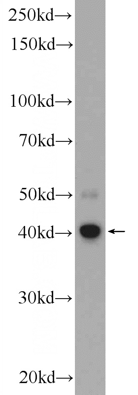 COLO 320 cells were subjected to SDS PAGE followed by western blot with Catalog No:108737(C5orf4 Antibody) at dilution of 1:300