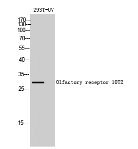 Fig1:; Western Blot analysis of 293T-UV cells using Olfactory receptor 10T2 Polyclonal Antibody diluted at 1: 500