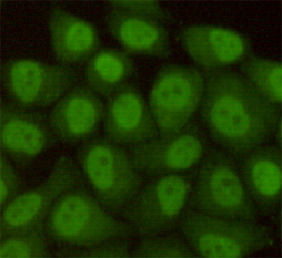 Immunocytochemistry staining of HeLa cells fixed with 4% Paraformaldehyde and using anti-hHR23b antibody (dilution 1:100).