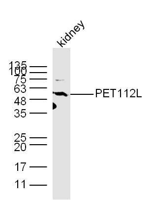 Fig1: Sample: Kidney (Mouse) Lysate at 40 ug; Primary: Anti-PET112L at 1/300 dilution; Secondary: HRP conjugated Goat-Anti-rabbit IgG (bs-0295G-HRP) at 1/5000 dilution; Predicted band size: 58 kD; Observed band size: 58 kD