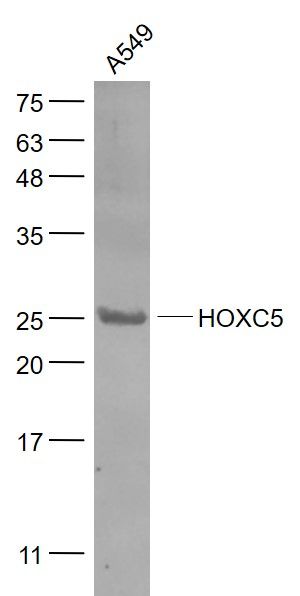 Fig1: Sample:; A549(Human) Cell Lysate at 30 ug; Primary: Anti- HOXC5 at 1/1000 dilution; Secondary: IRDye800CW Goat Anti-Rabbit IgG at 1/20000 dilution; Predicted band size: 25 kD; Observed band size: 25 kD
