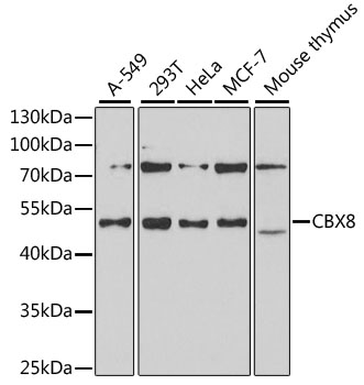 Western blot - CBX8 Polyclonal Antibody 