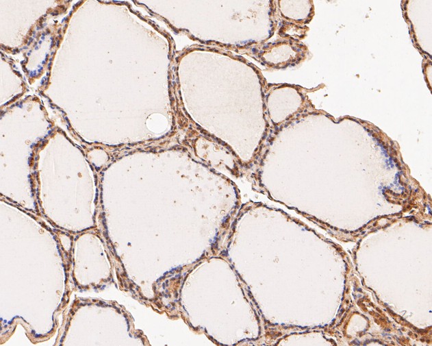 Fig4:; Immunohistochemical analysis of paraffin-embedded human thyroid tissue using anti-FYCO1 antibody. The section was pre-treated using heat mediated antigen retrieval with Tris-EDTA buffer (pH 8.0-8.4) for 20 minutes.The tissues were blocked in 5% BSA for 30 minutes at room temperature, washed with ddH; 2; O and PBS, and then probed with the primary antibody ( 1/500) for 30 minutes at room temperature. The detection was performed using an HRP conjugated compact polymer system. DAB was used as the chromogen. Tissues were counterstained with hematoxylin and mounted with DPX.