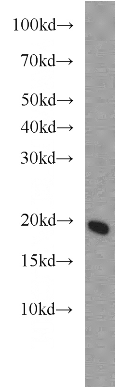 Jurkat cells were subjected to SDS PAGE followed by western blot with Catalog No:116531(UBE2L6 antibody) at dilution of 1:1000
