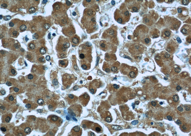 Immunohistochemistry of paraffin-embedded human liver slide using Catalog No:107274(IDS Antibody) at dilution of 1:50