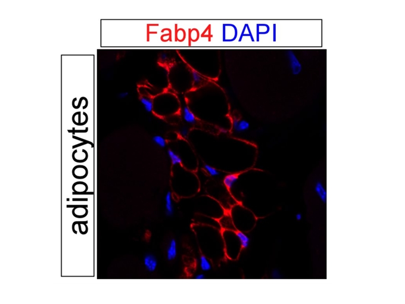 IF result of anti-FABP4 (Catalog No:110439, 1:500) with PFA fixed mouse adipose tissue by Dr. Daniel Kopinke.