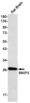 Western blot detection of BNIP3 in Rat Brain lysates using BNIP3 Rabbit pAb(1:500 diluted).Predicted band size:28kDa.Observed band size:28kDa.
