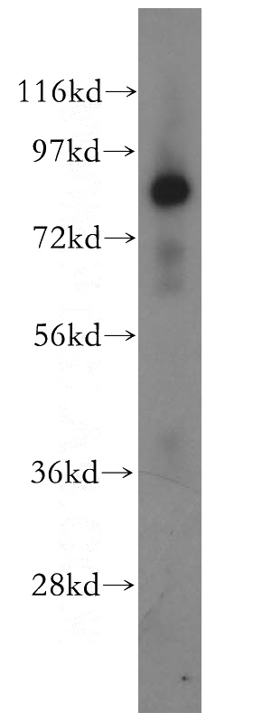 human liver tissue were subjected to SDS PAGE followed by western blot with Catalog No:111522(HOOK3 antibody) at dilution of 1:500