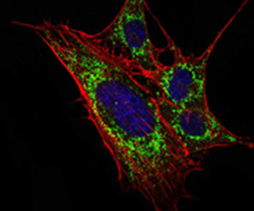 Fig2: ICC staining KLHL11 (green) and Actin filaments (red) in 3T3-L1 cells. The nuclear counter stain is DAPI (blue). Cells were fixed in paraformaldehyde, permeabilised with 0.25% Triton X100/PBS.