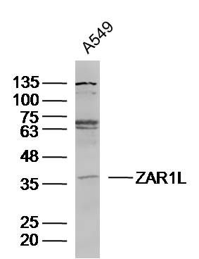 Fig1: Sample:A549 (Human)cell Lysate at 40 ug; Primary: Anti-ZAR1L at 1/300 dilution; Secondary: IRDye800CW Goat Anti-RabbitIgG at 1/20000 dilution; Predicted band size: 36kD; Observed band size: 36kD