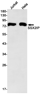 Western blot detection of SSX2IP in Jurkat,Hela cell lysates using SSX2IP Rabbit mAb(1:1000 diluted).Predicted band size:71kDa.Observed band size:71kDa.