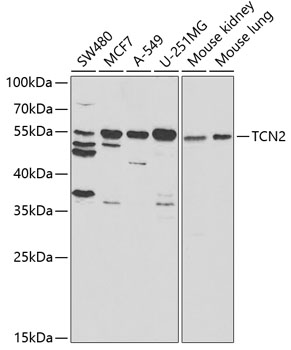 Western blot - TCN2 Polyclonal Antibody 