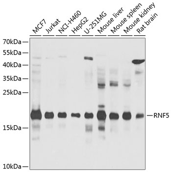 Western blot - RNF5 Polyclonal Antibody 