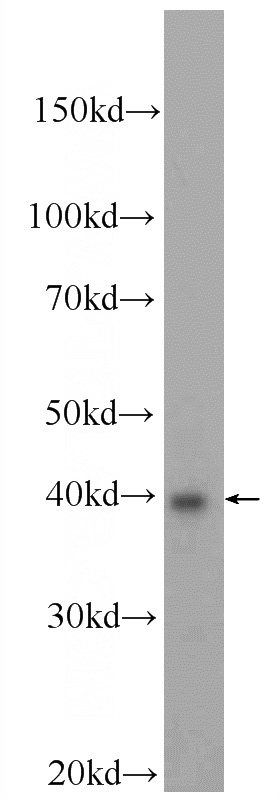 MCF-7 cells were subjected to SDS PAGE followed by western blot with Catalog No:117240(BRMS1L Antibody) at dilution of 1:600