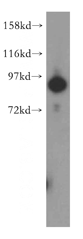 human brain tissue were subjected to SDS PAGE followed by western blot with Catalog No:116467(UBA2 antibody) at dilution of 1:500