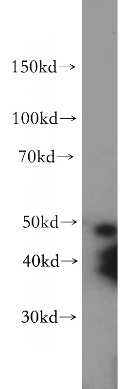 HEK-293 cells were subjected to SDS PAGE followed by western blot with Catalog No:108738(C5orf44 antibody) at dilution of 1:500