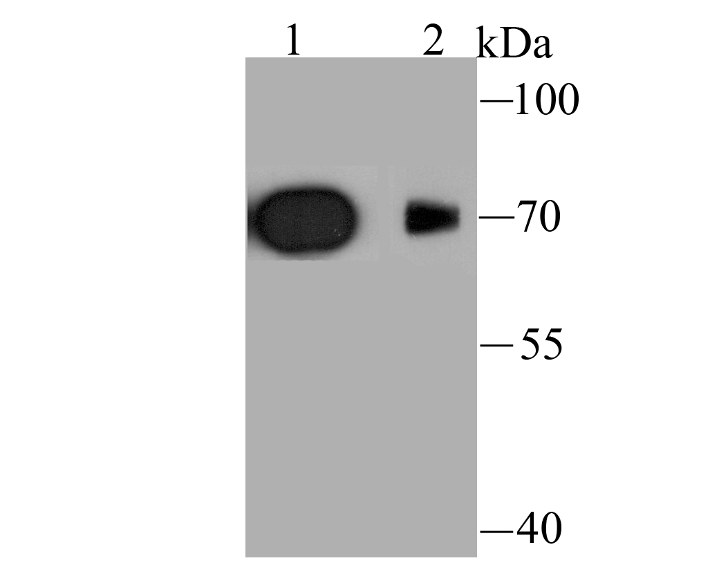 Fig1: Western blot analysis of Kv1.4 on rat brain (1) and mouse brain (2) tissue lysate using anti-Kv1.4 antibody at 1/1,000 dilution.