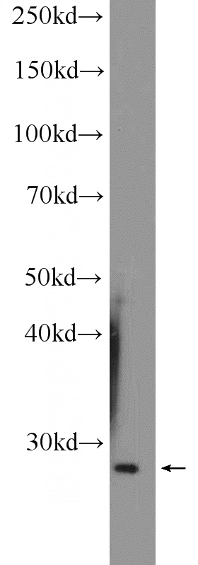 Raji cells were subjected to SDS PAGE followed by western blot with Catalog No:111730(HVCN1 Antibody) at dilution of 1:600