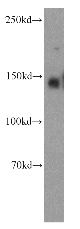 HeLa cells were subjected to SDS PAGE followed by western blot with Catalog No:111996(KIAA1602 antibody) at dilution of 1:300