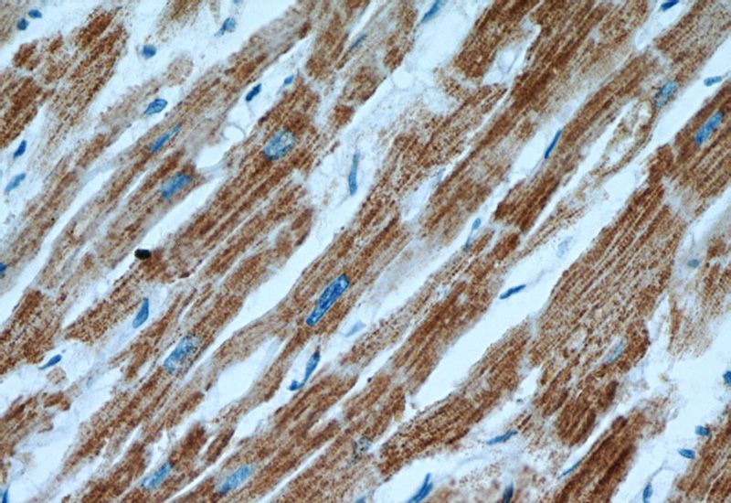 Immunohistochemical of paraffin-embedded human heart using Catalog No:109484(COX15 antibody) at dilution of 1:100 (under 40x lens)