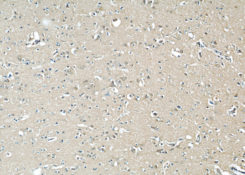 Immunohistochemical of paraffin-embedded human brain using Catalog No:107251(EIF3D antibody) at dilution of 1:50 (under 10x lens)