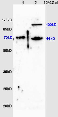 Fig1: Sample:; Lane 1: Testis (Mouse) Lysate at 30 ug; Lane 2: Small intestine (Mouse) Lysate at 30 ug; Primary: Anti-ZNF300 at 1:200 dilution;; Secondary: HRP conjugated Goat-Anti-Rabbit IgG(bs-0295G-HRP) at 1:3000 dilution;; Predicted band size : 66kD; Observed band size : 70,66kD