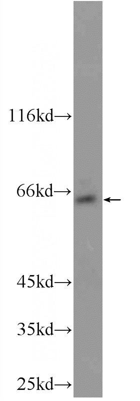 HEK-293 cells were subjected to SDS PAGE followed by western blot with Catalog No:115867(TBC1D24 Antibody) at dilution of 1:1000