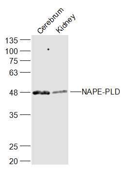 Fig1: Sample:; Cerebrum (Mouse) Lysate at 40 ug; Kidney (Mouse) Lysate at 40 ug; Primary: Anti-NAPE-PLD at 1/300 dilution; Secondary: IRDye800CW Goat Anti-Rabbit IgG at 1/20000 dilution; Predicted band size: 46 kD; Observed band size: 46 kD