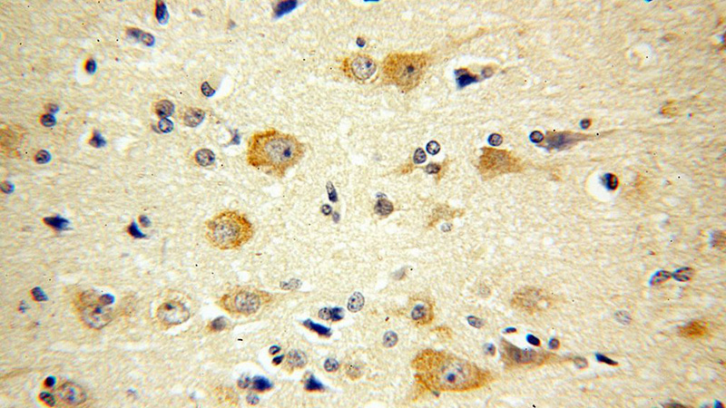 Immunohistochemical of paraffin-embedded human brain using Catalog No:108238(ARC antibody) at dilution of 1:100 (under 40x lens)