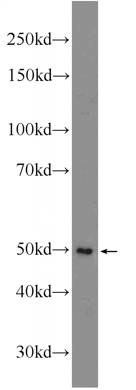 Jurkat cells were subjected to SDS PAGE followed by western blot with Catalog No:108069(ANKRD13D Antibody) at dilution of 1:300