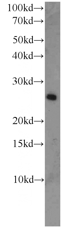 mouse brain tissue were subjected to SDS PAGE followed by western blot with Catalog No:113153(NFIX-Specific antibody) at dilution of 1:500