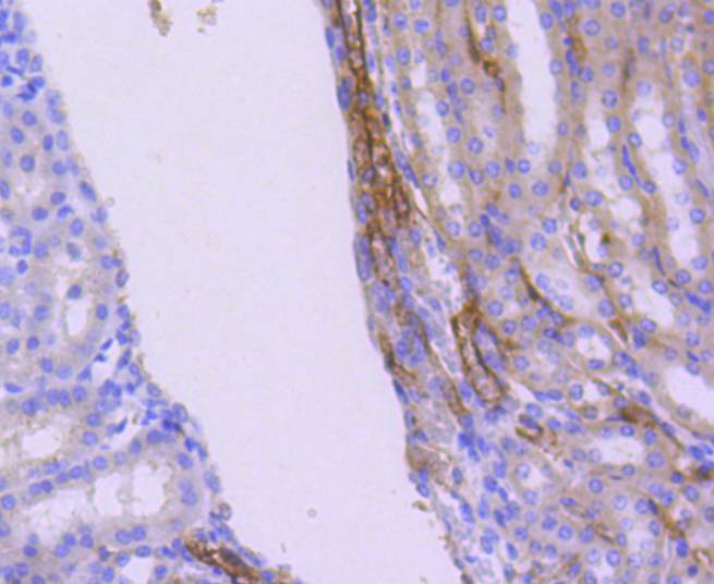 Fig3:; Immunohistochemical analysis of paraffin-embedded mouse kidney tissue using anti-WASF2 antibody. The section was pre-treated using heat mediated antigen retrieval with Tris-EDTA buffer (pH 8.0-8.4) for 20 minutes.The tissues were blocked in 5% BSA for 30 minutes at room temperature, washed with ddH; 2; O and PBS, and then probed with the primary antibody ( 1/50) for 30 minutes at room temperature. The detection was performed using an HRP conjugated compact polymer system. DAB was used as the chromogen. Tissues were counterstained with hematoxylin and mounted with DPX.
