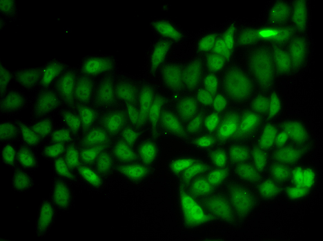 Immunofluorescence - ATXN1 Polyclonal Antibody 