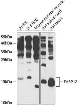 Western blot - FABP12 Polyclonal Antibody 