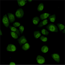 Immunocytochemistry staining of HeLa cells fixed with 4% Paraformaldehyde and using TBLR1 mouse mAb (dilution 1:200).
