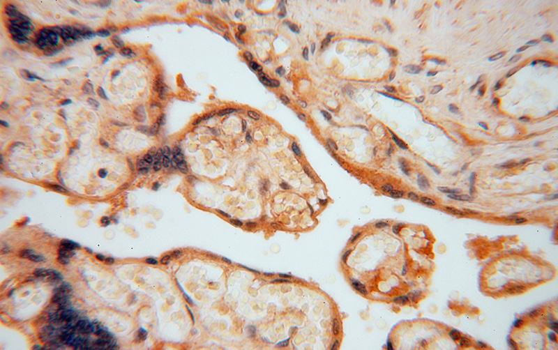 Immunohistochemical of paraffin-embedded human placenta using Catalog No:111354(HIP1R antibody) at dilution of 1:100 (under 40x lens)